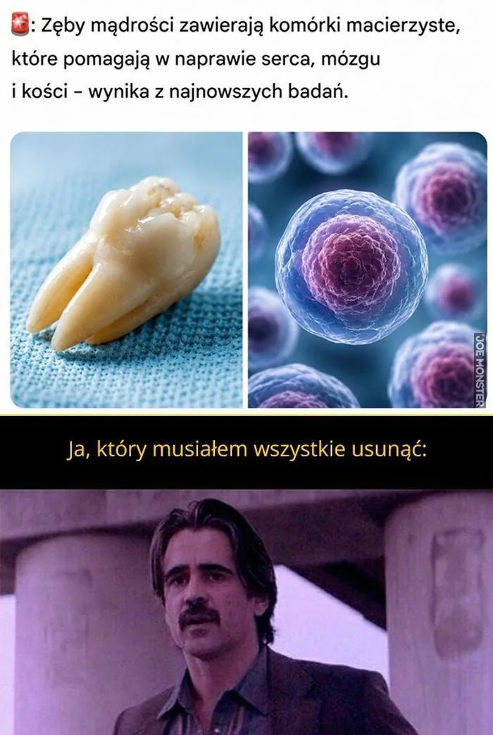 Zęby mądrości zawierają komórki macierzyste, które pomagają w naprawie serca, mózgu i kości - wynika z najnowszych badań.
Ja, który musiałem wszystkie usunąć: